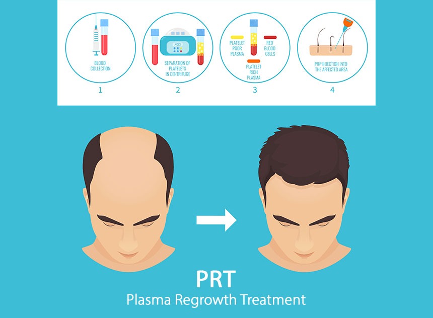 Plasma Hair Regrowth Treatment | Innovation Dermatology | Red Deer Dermatology & Med Spa Clinic