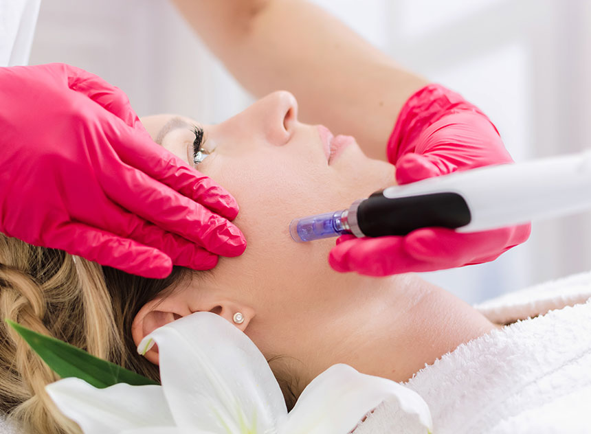 Infini RF Microneedling | Innovation Dermatology | Red Deer Dermatology & Med Spa Clinic