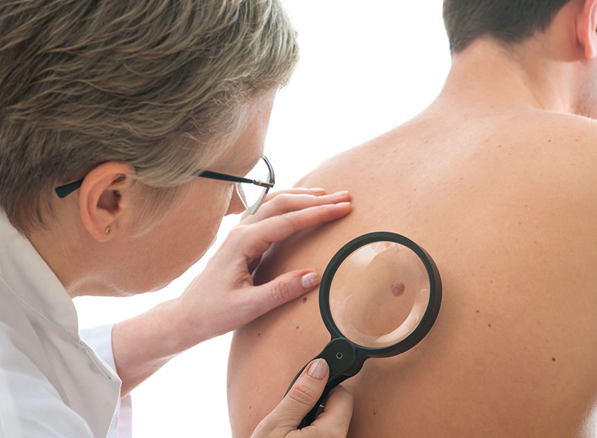 Skin Cancer Surgery | Innovation Dermatology | Red Deer Dermatology & Med Spa Clinic